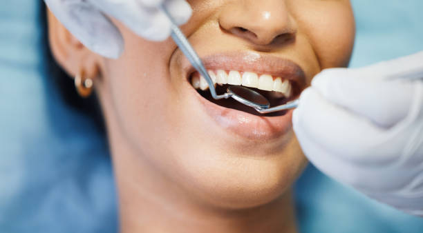 Best Emergency Dental Care for Sports Injuries in University, MS