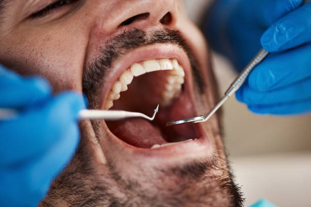 Best Emergency Dental Care for Sports Injuries in University, MS