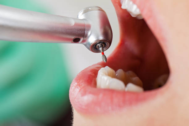 Best 24-Hour Emergency Dental Care in University, MS